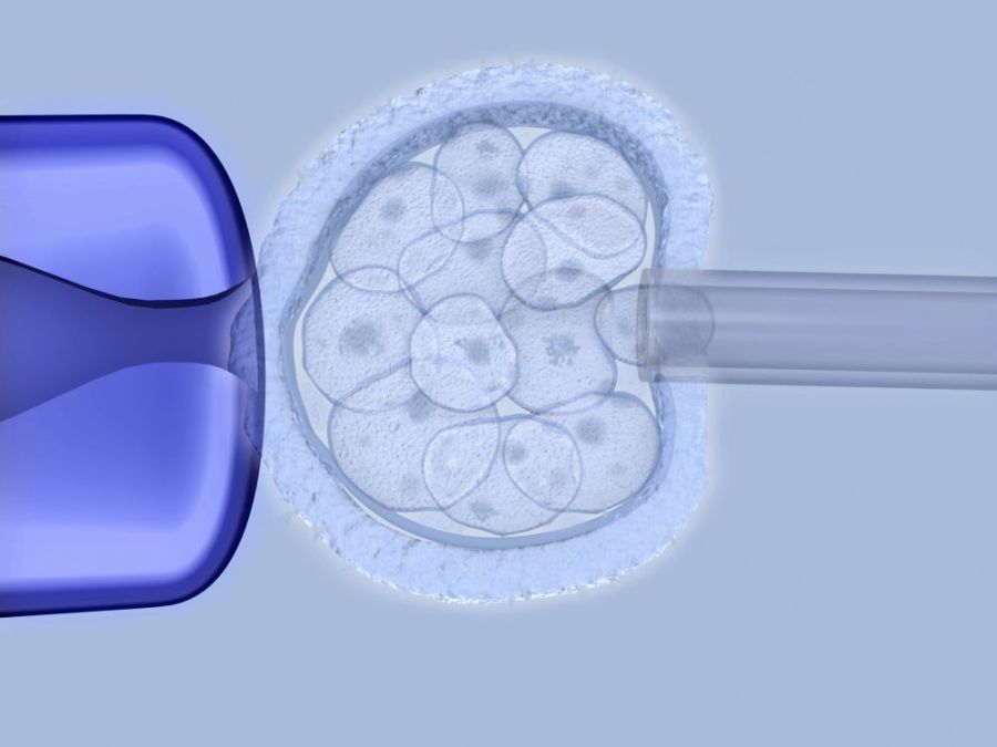 2017.09.19 PMA cover-r4x3w1000-59523398e1614-049-f0090532