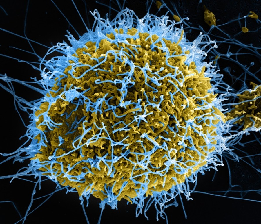 virus ebola 14440817981_ec46c31212_o-1024x882
