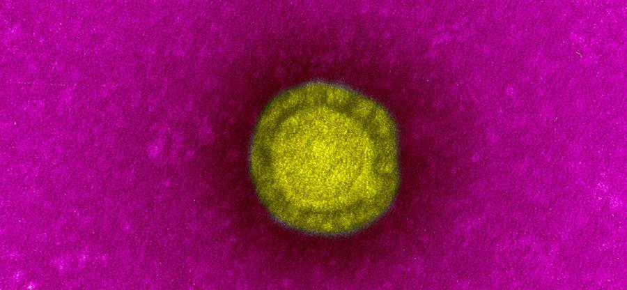 slider-coronavirus_17087