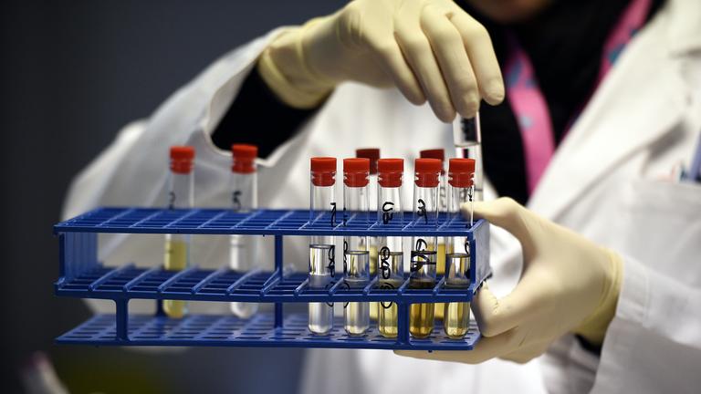 FRANCE-DOPING-LABORATORY